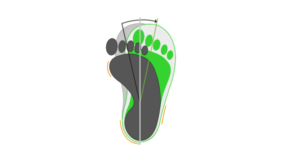 Antivarus shoe